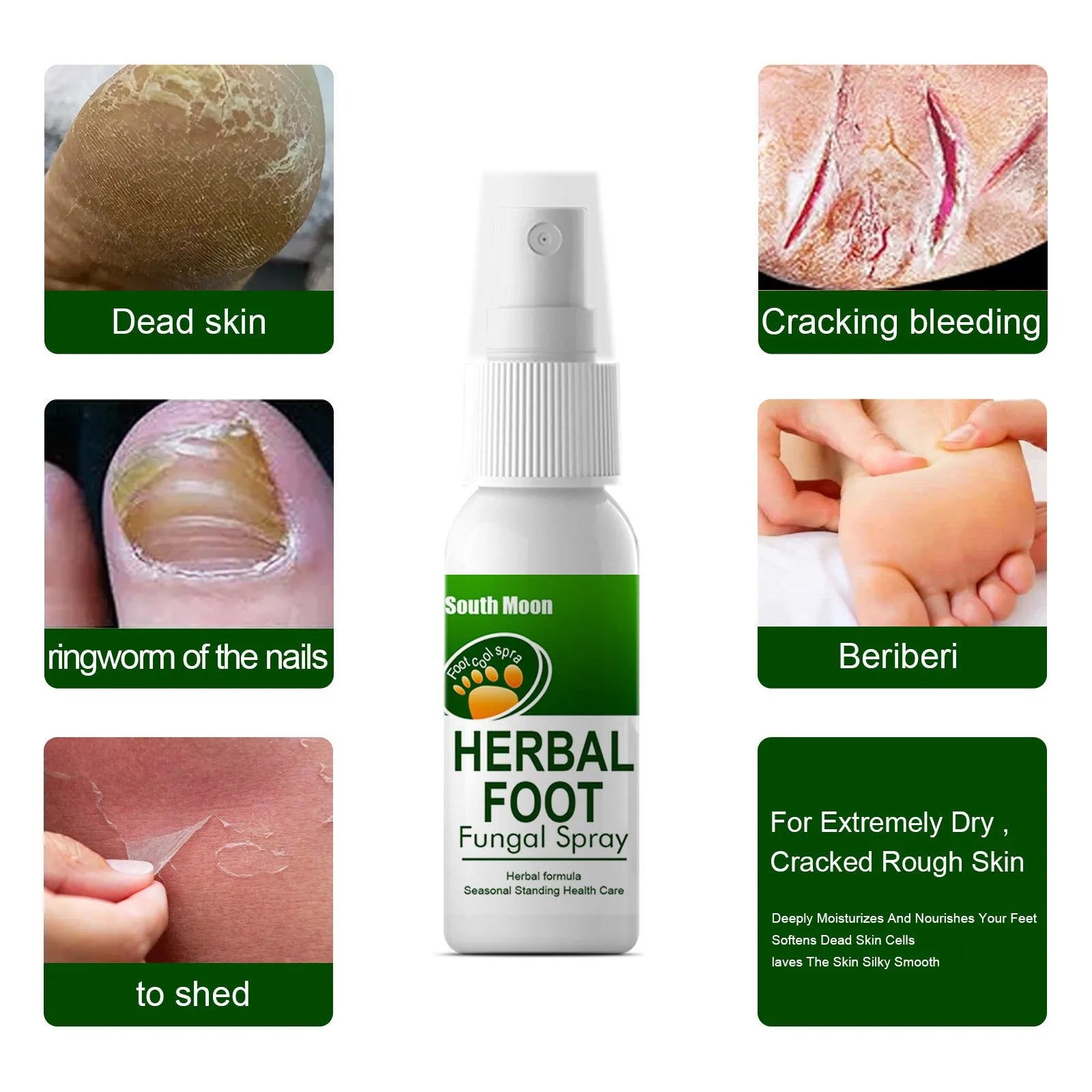 30ml foot care spray bottle for nourishing and hydrating foot skin