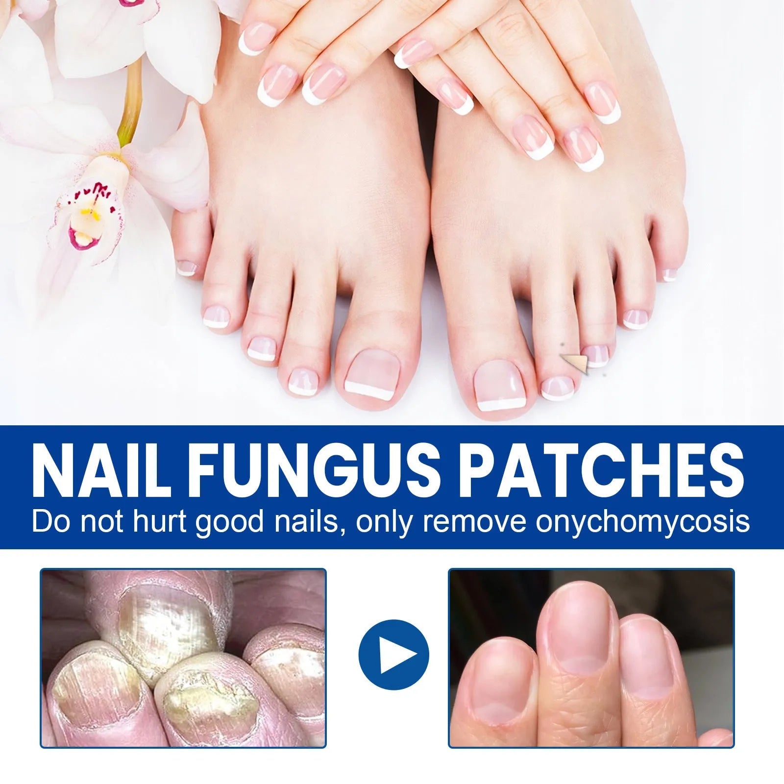 Box of 32 nail repair adhesive bandages, each patch 6.1 by 3.5 cm