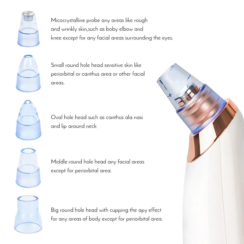 Electric blackhead remover device with four nozzle attachments for pore cleaning and acne extraction