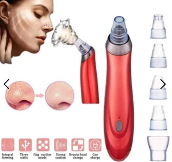 Electric blackhead remover device with four nozzle attachments for pore cleaning and acne extraction