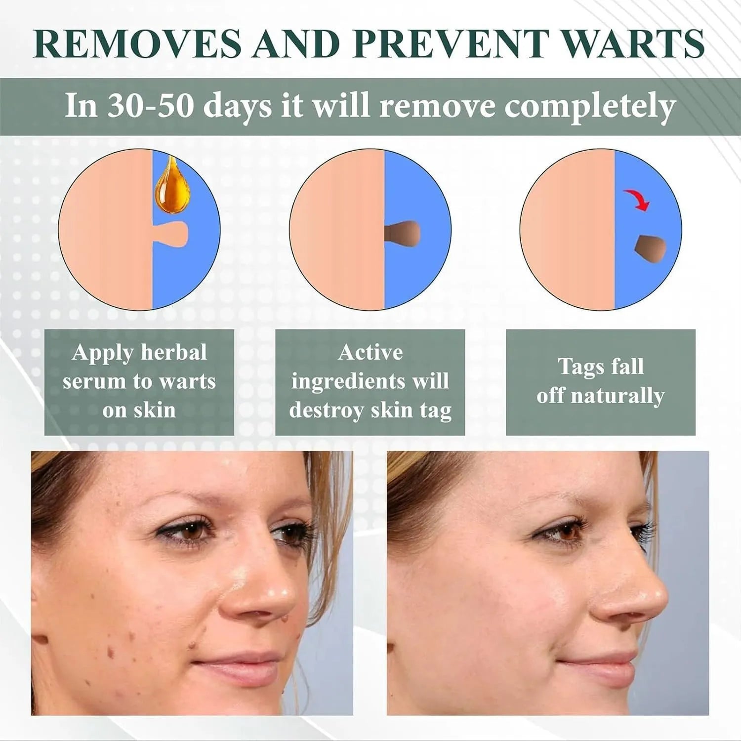 Natureerase Instant Mole Spot Removal Gel 45g hydrating treatment tube
