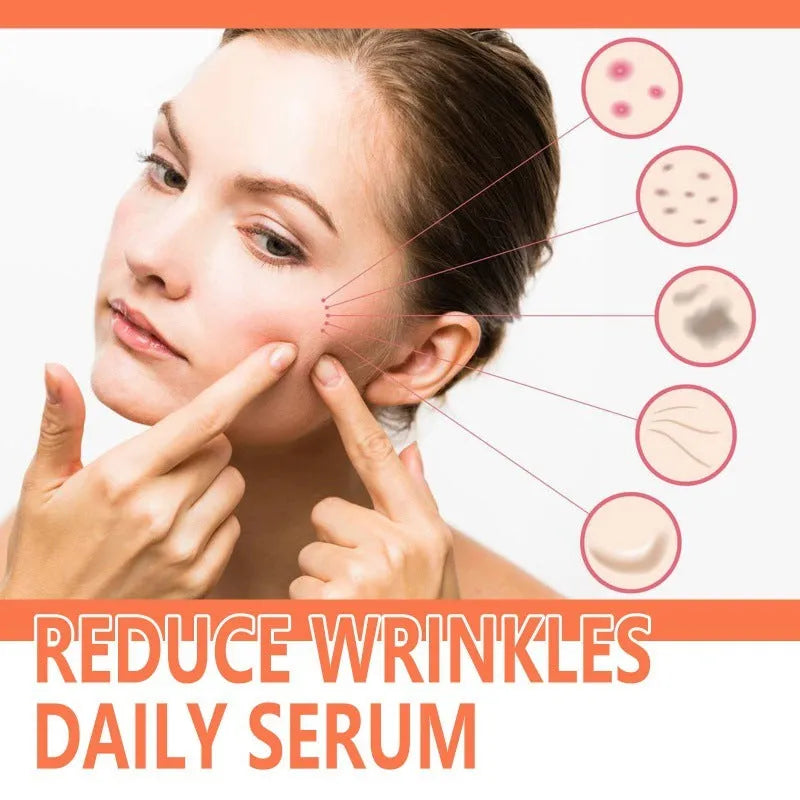 30ml rose essential oil bottle for wrinkle smoothing and skin brightening skincare