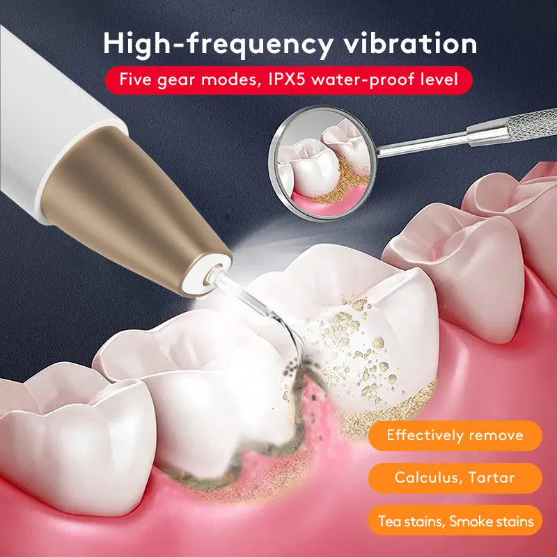 Gold ultrasonic tooth cleaning device for tartar and stain removal at home