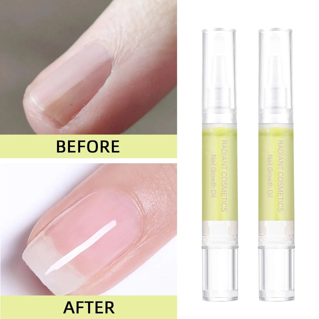 3ml bottle of nail growth oil with moisturising wash-free formula for nail care treatment