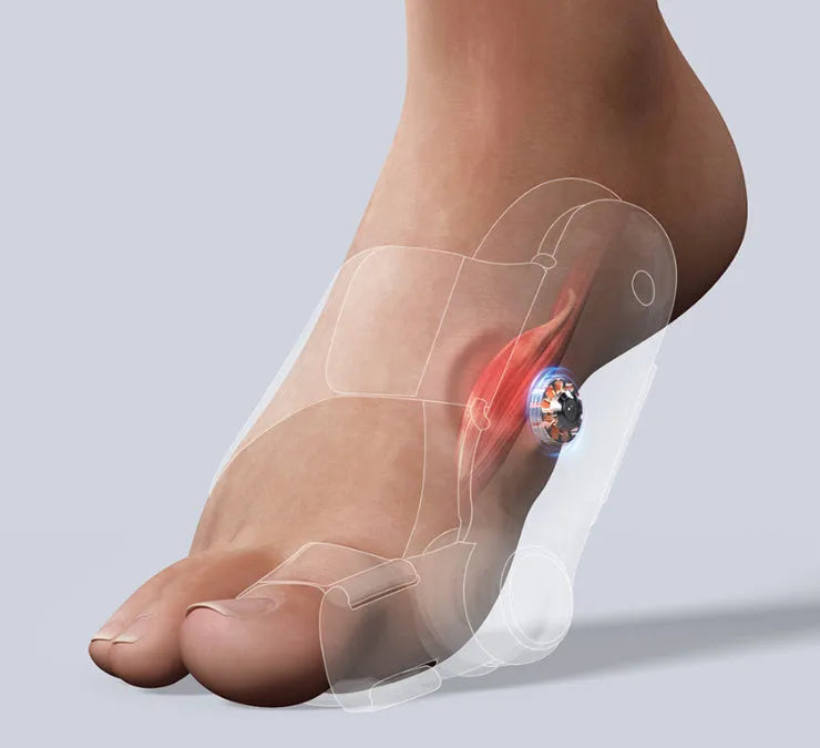 White plastic electric adjustable hallux valgus toe separator with Type-C charging cable