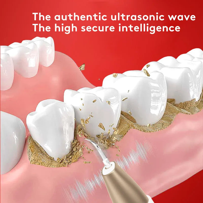 Gold ultrasonic tooth cleaning device for tartar and stain removal at home